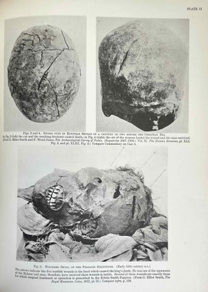 The Edwin Smith surgical papyri. Vol. I: Hieroglyphic Transliteration, Translation and Commentary. Vol. II: Facsimile Plates and Line for Line Hieroglyphic Transliteration (complete set)