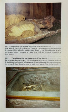 Les momies des pharaons et la médecine. Ramsès II à Paris. Le pharaon et Moïse.