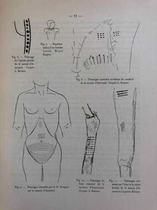 Remarques sur le tatouage dans l’Égypte ancienne[newline]M2135b-10.jpg