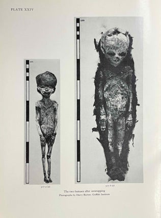 Item #M3948f The human remains from the tomb of Tutankhamun. LEEK Frank Filce