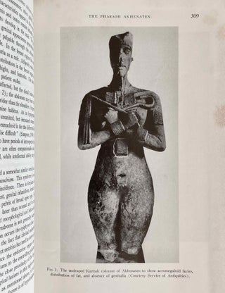 The Pharaoh Akhenaten. A problem in egyptology and pathology.[newline]M8616-06.jpeg